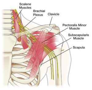 brachial plexus-4